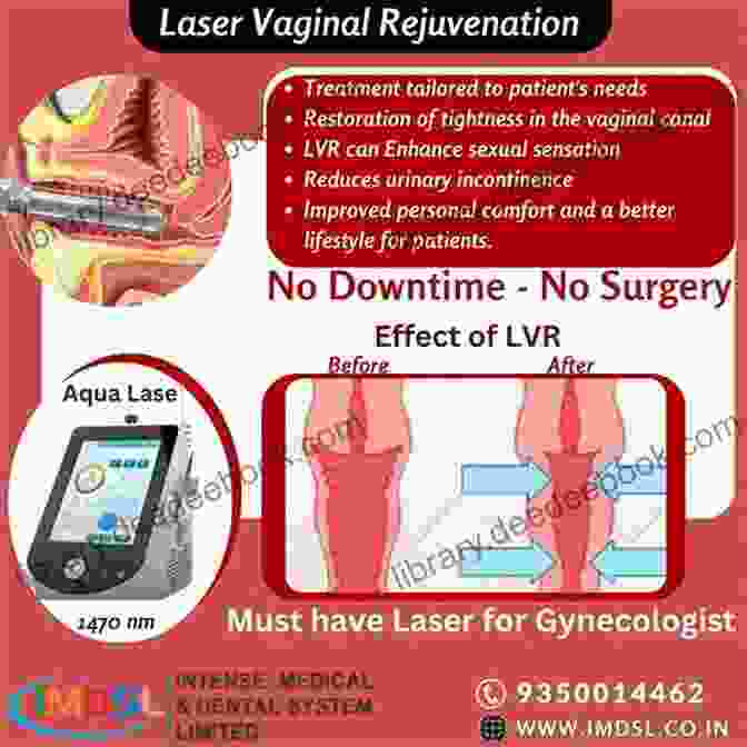A Vaginal Rejuvenation Procedure Being Performed Using A Laser. Aesthetic And Regenerative Gynecology Narendra Malhotra